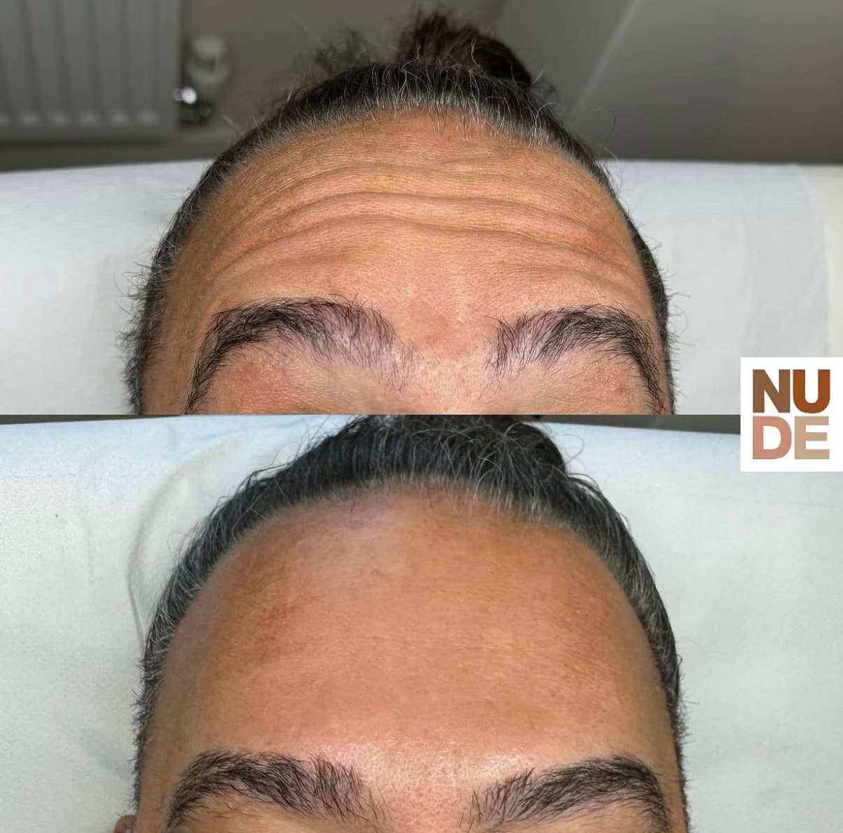 Anti-Wrinkle Results result 1