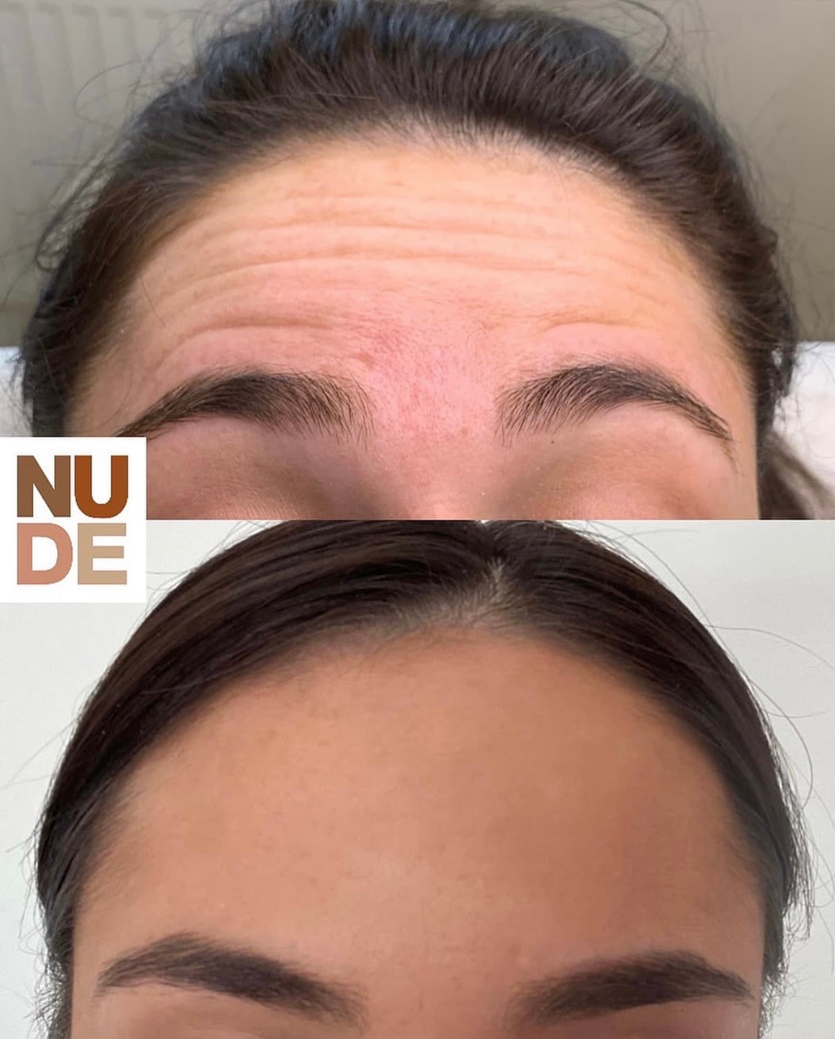 Anti-Wrinkle Results result 2