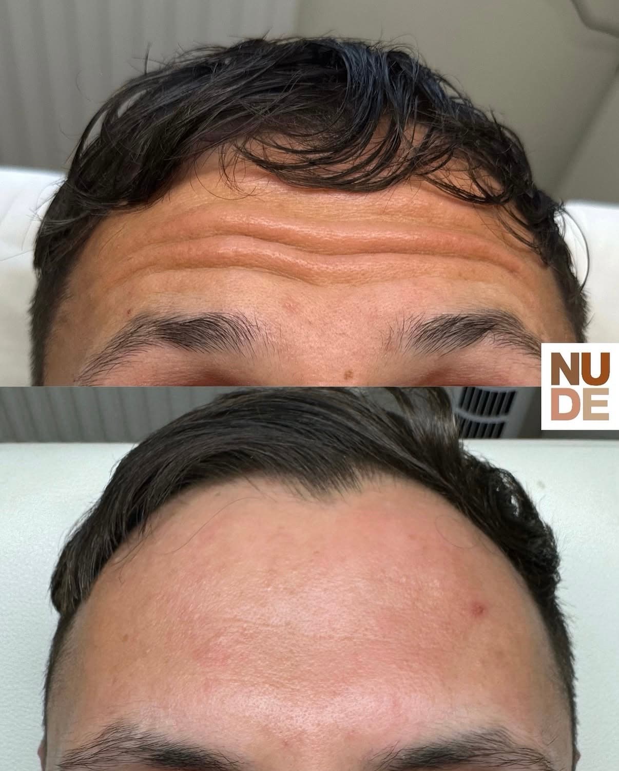 Anti-Wrinkle Results result 3