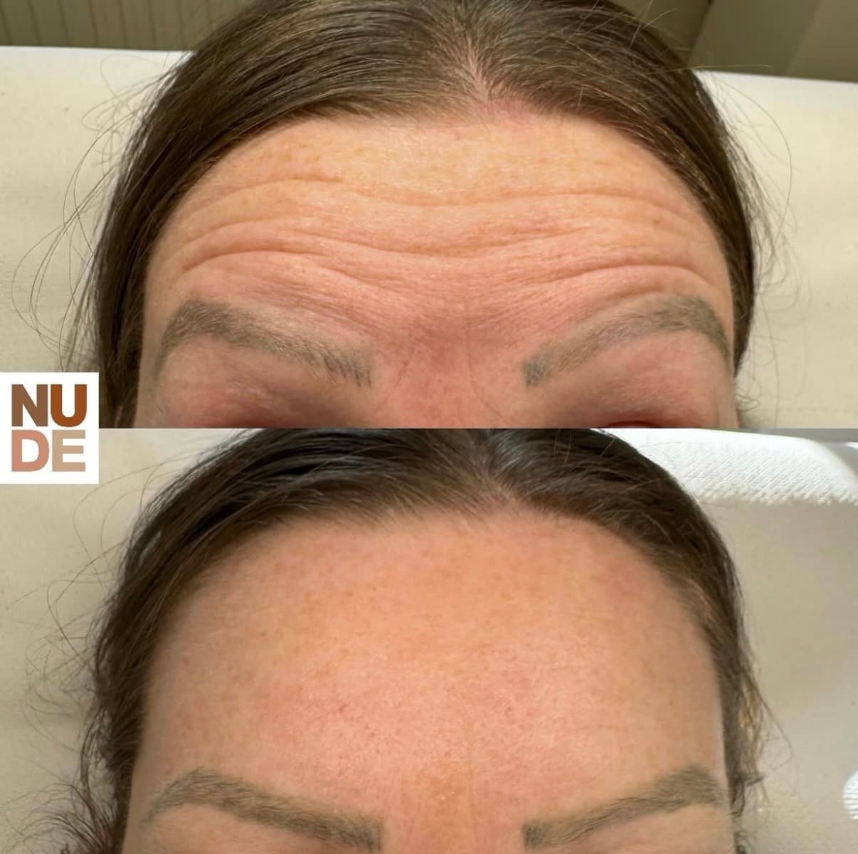 Anti-Wrinkle Results result 4