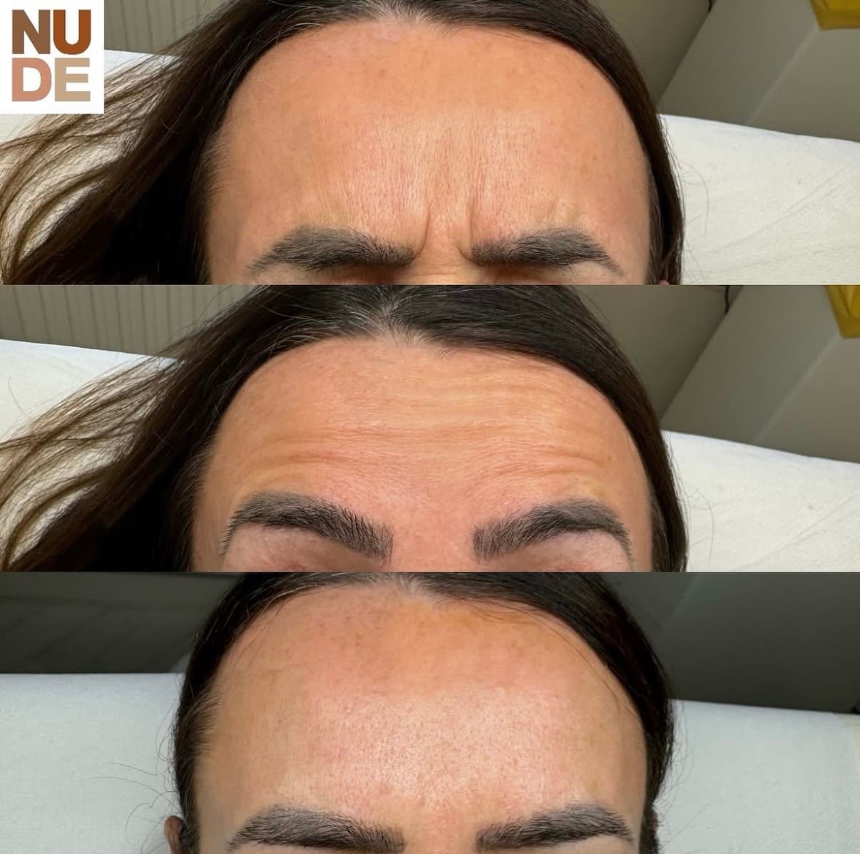 Anti-Wrinkle Results result 5
