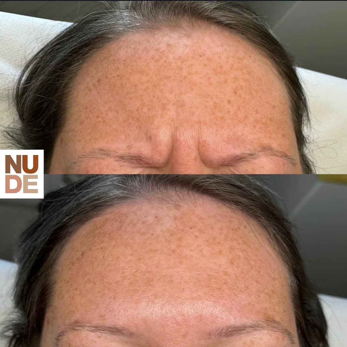 Anti-Wrinkle Results result 6