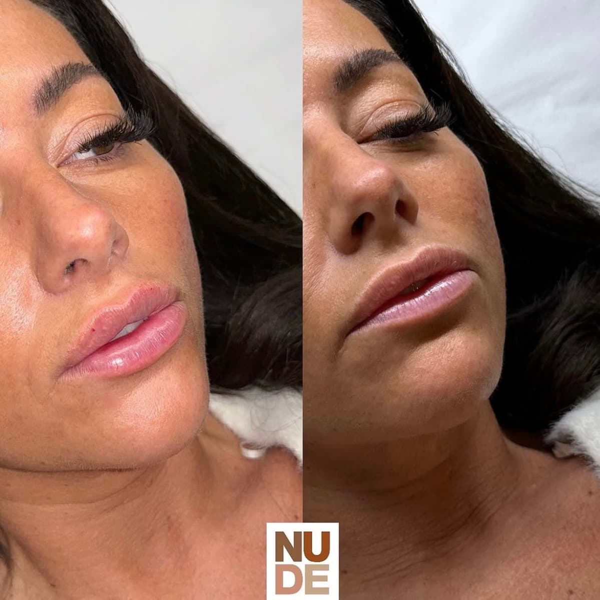 Lip Enhancement Results result 4