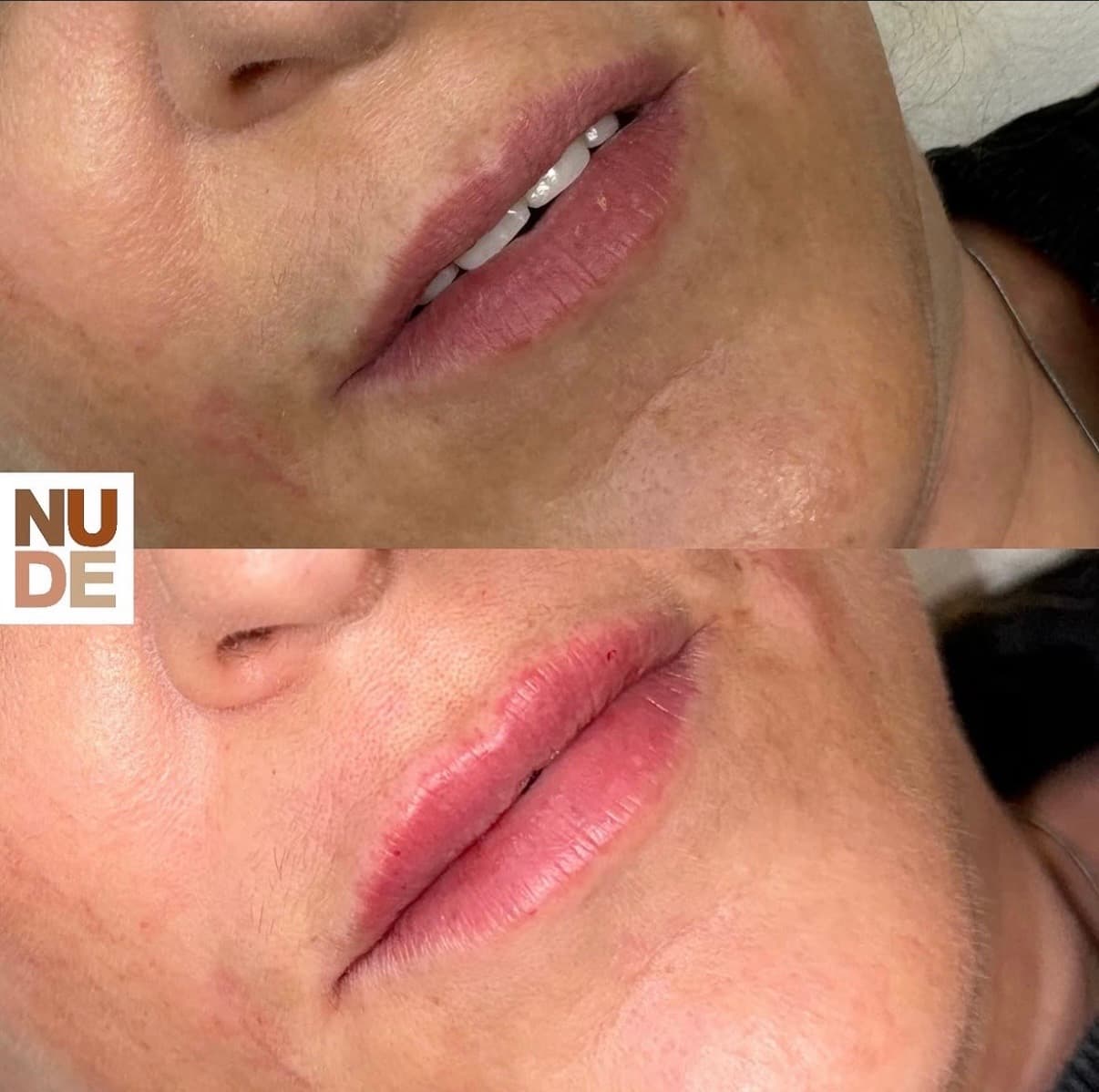 Lip Enhancement Results result 5